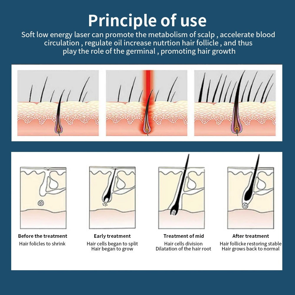 Red Light Hair Growth Cap